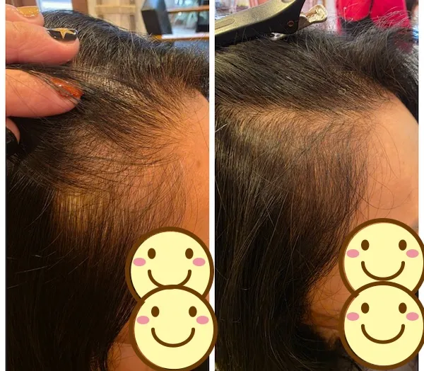 エイジングショット Before/After 8