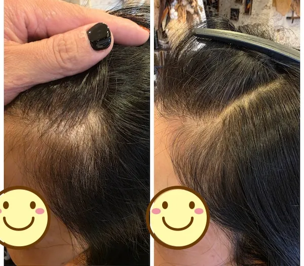 エイジングショット Before/After 8