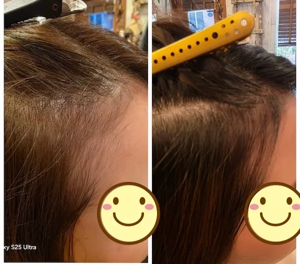 エイジングショット1