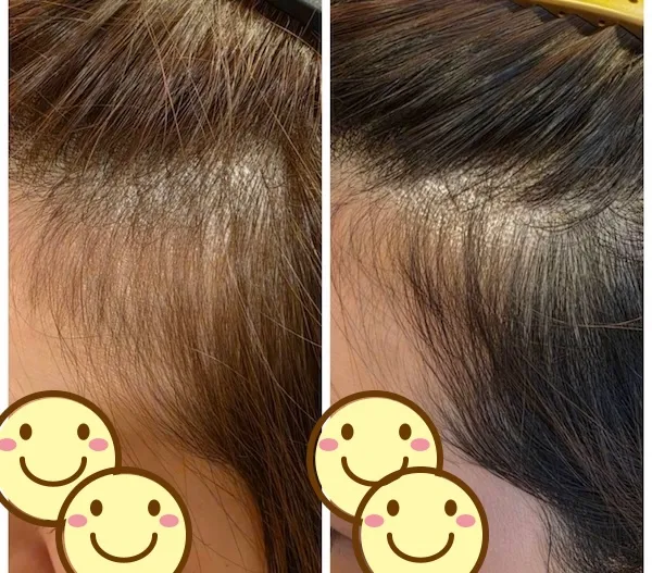 エイジングショット2