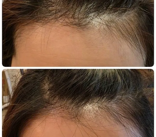 エイジングショット3