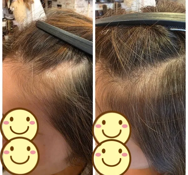 エイジングショット Before/After 10