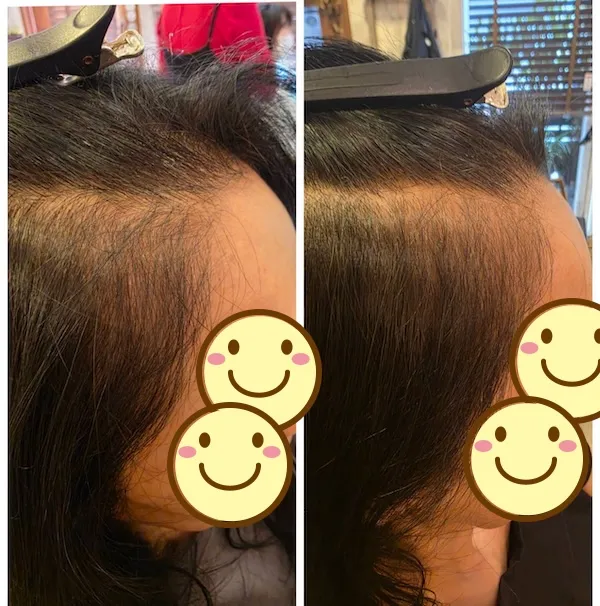 エイジングショット Before/After 8