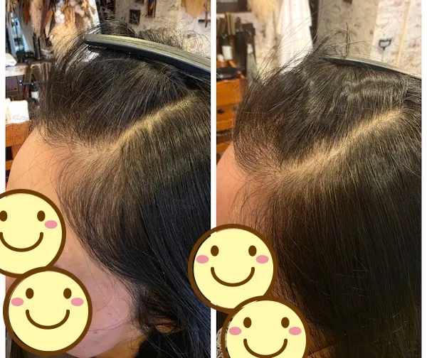 エイジングショット Before/After 8
